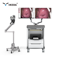 IKEDA Digitales Video-Kolposkop LED Optisches Bildgebungssystem für Gynäkologische Kliniken, CE & ISO Zertifiziert
