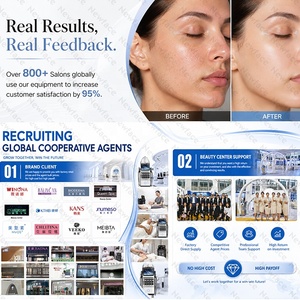Nuovo Dispositivo Professionale <span class=keywords><strong>per</strong></span> Idrodermabrasione NewFace, Attrezzatura <span class=keywords><strong>per</strong></span> Estetiste, Macchina <span class=keywords><strong>per</strong></span> Peeling ad <span class=keywords><strong>Acqua</strong></span> e Ringiovanimento della Pelle <span class=keywords><strong>per</strong></span> Centri Estetici - Product Image 3