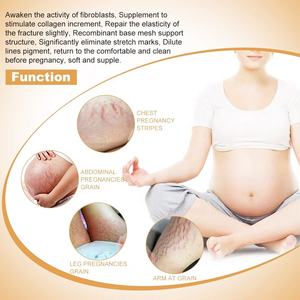 Crema para el Cuidado de la Piel de Marca Privada, Crema de Mango para <span class=keywords><strong>Eliminar</strong></span> Estrías del Embarazo, Crema Anti-Estrías - Product Image 4