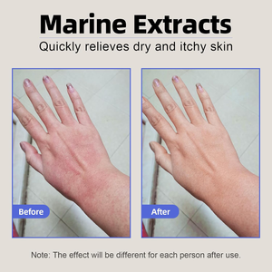 <span class=keywords><strong>Crema</strong></span> <span class=keywords><strong>Facial</strong></span> Reparadora Profunda, Hidratante y <span class=keywords><strong>Protectora</strong></span> para el Cuidado de la Piel Después del Tratamiento, la Más Vendida del 2025 - Product Image 4