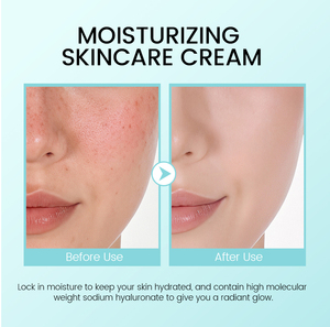 Moisturizing & Nourishing Hyaluronic Acid & Centella Soothing Anti-Wrinkle Firming Face & Body Cream for All Skin Types - Product Image 5