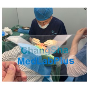 Kit de Instrumentos Quirúrgicos para Trasplante Capilar con Motor de Alta Velocidad para Extracción e Implante de Unidades Foliculares - Product Image 2