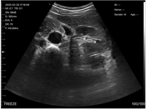 B26G Portable Médical Couleur Doppler Sonde Poche Sans Fil Wi-Fi Machine À Ultrasons scanner à ultrasons sans fil - Product Image 5