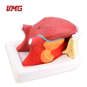 Modelo de Lengua y Dientes Desmontable 2.5 veces más Grande, de Plástico, para Demostración de la Cavidad Oral y la Mandíbula Inferior - Product Image 6