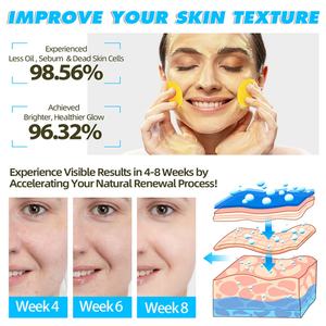 Almohadillas Limpiadoras Faciales de Ácido Kójico y Cúrcuma, 60 Unidades, Venta al por Mayor de Fábrica, Aptas para Todo Tipo de Piel - Product Image 5