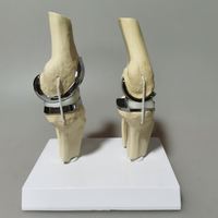 Modèle de prothèse de genou artificielle détachable KyrenMed, petit modèle d'implant de genou double argenté