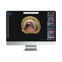 Software industriale digitale personalizzato per l'analisi della morfologia dei denti monitoraggio dell'usura apprendimento profondo AI piattaforme mobili/Desktop