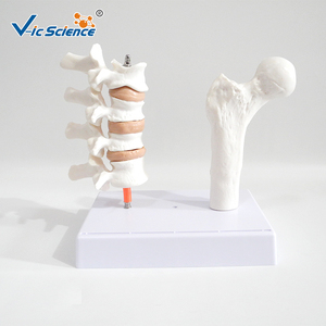 Modèle d'os pathologique en PVC pour l'ostéoporose avec carte dorsale - Modèle de <span class=keywords><strong>squelette</strong></span> <span class=keywords><strong>humain</strong></span> - Product Image 1