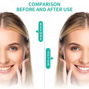 Offre d'usine en gros : Kit de blanchiment des dents à domicile de luxe en boîte - Product Image 6