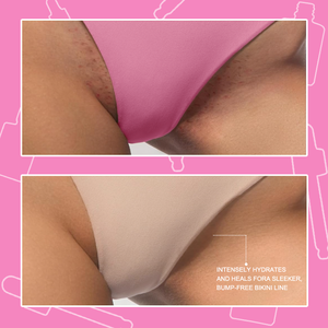 GUOCUI BIO TECH Huile post-rasage pour aisselles, intime, incarnée, apaisante et anti-rougeurs, puissante huile après-rasage hydratante pour femmes - Product Image 5