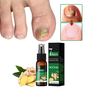 Marque privée Nouveauté 2025 Spray <span class=keywords><strong>antifongique</strong></span> pour ongles 7 jours Répare les dommages aux ongles et aux cuticules Produits <span class=keywords><strong>de</strong></span> soin <span class=keywords><strong>de</strong></span> la peau 30ml MOOYAM Spray pour ongles - Product Image 1