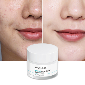Crema de gelatina de retinol para eliminar el acné, fórmula no comedogénica de ceramida <span class=keywords><strong>Aqua</strong></span>, previene los brotes, se desvanece, cicatrices, piel sensible, amigable - Product Image 1
