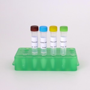 H1N1 <span class=keywords><strong>Grippe</strong></span> A Virus RT-PCR Kit Détection Rapide - Product Image 2
