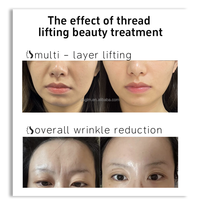 Appareil de beauté à usage domestique 2026, masseur facial portable, lifting du visage, nettoyeur facial sonique, machine de rajeunissement de la peau