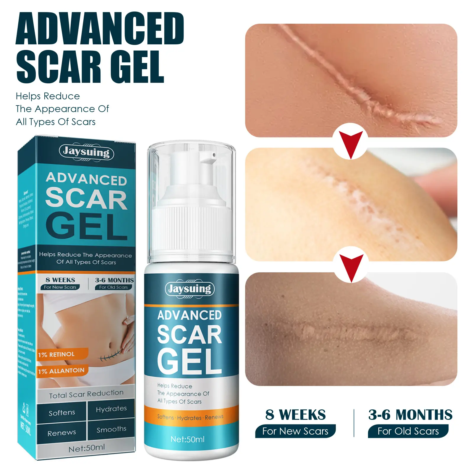 Jaysuing advanced Fastest Acne Scar Removal Cream Scar Gel Bruises Repair Cream Tummy Tuck Tightening Stretch Mark Scar Removal