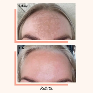 Aceite para Equilibrar la Piel y Aclarar Manchas Oscuras, Logra un Tono Uniforme, Belleza Interior, Cápsulas Veganas Limpiadoras - Product Image 2