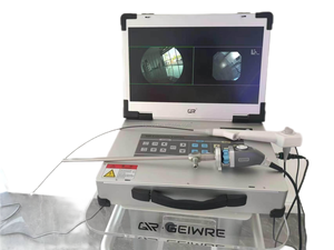 Système d'endoscopie tout-en-un Endoscope vidéo électronique médical Appareil d'endoscopie Gastroscope Colonoscope <span class=keywords><strong>Laryngoscope</strong></span> Cysto - Product Image 4