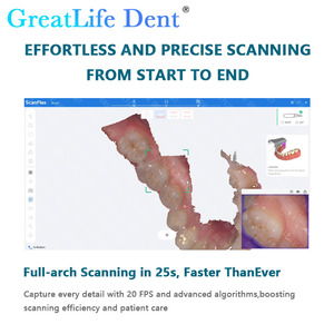 Escáner Dental Intraoral 3D Fussen S6500 en Oferta, Escáner Oral Digital de Cerámica 3D con Puntas Intercambiables - Product Image 3