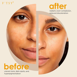 Nhãn Hiệu Riêng Kojic Axit Xà Phòng Với Phi Net Miếng Bọt Biển Đậm Điểm Remover Hand <span class=keywords><strong>Made</strong></span> Xà Phòng Nghệ Hyaluronic Axit VC Barth Xà Phòng - Product Image 4