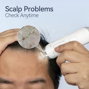 Kimairay <span class=keywords><strong>USB</strong></span> WIFI Android: <span class=keywords><strong>Detector</strong></span> de Análise de Pele e Folículos Capilares HD para Telefone, Cuidados com o Cabelo Branco e Couro Cabeludo para Uso Doméstico - Product Image 2