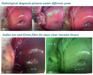 Endoscopia Médica Hd Vídeo Optical Digital Colposcópio Colposcópio Eletrônico Preço para Ginecologia - Product Image 6