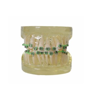 Modèle de dents dentaires/modèle orthodontique <span class=keywords><strong>dentaire</strong></span> avec supports métalliques - Product Image 6