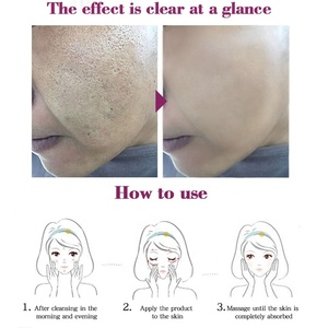 Crème réparatrice contre l'acné Anti-acné <span class=keywords><strong>hydratante</strong></span> <span class=keywords><strong>cicatrice</strong></span> points noirs rétrécissement Pores blanchissant soins de la peau du visage crème contre l'acné - Product Image 5