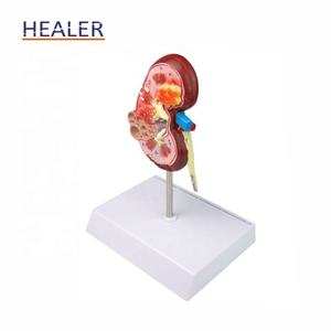 Modelo anatómico de riñón humano, modelo de piedra <span class=keywords><strong>renal</strong></span> de patología <span class=keywords><strong>renal</strong></span> de ciencia médica de PVC para uso escolar - Product Image 4