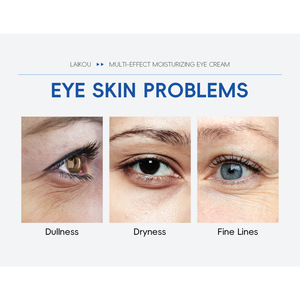 Crema hidratante <span class=keywords><strong>para</strong></span> <span class=keywords><strong>ojos</strong></span> antienvejecimiento, iluminadora, suavizante, reafirmante, hidratante con triple rodillo <span class=keywords><strong>para</strong></span> ojeras - Product Image 3
