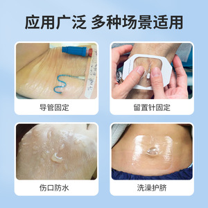 Weigao Transparent Medical Film <b>Dressing</b> 60x70cm <b>Waterproof</b> Adhesive For Intravenous Use - Product Image 3