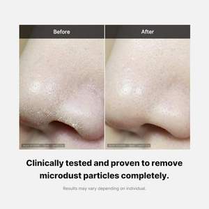 Limpiador Facial Sin <span class=keywords><strong>Espuma</strong></span> de 120g, Limpieza Profunda de Poros, Anticontaminación, con Extractos Naturales - Product Image 4