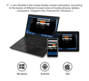 Sonostar Ultrasound 2 In 1 Dubbele Hoofd Kleur <span class=keywords><strong>Doppler</strong></span> Convex & Lineaire Ultrasound Machine Scanner - Product Image 5