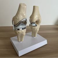 Modèle de prothèse de genou artificielle détachable KyrenMed, petit modèle d'implant de genou double argenté