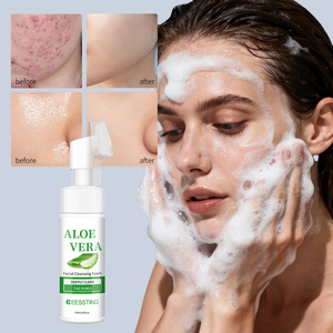 Mousse Nettoyante Visage Personnalisée au Logo, Nettoyage en Profondeur et Hydratation, Contrôle du Sébum, à l'Aloe Vera - Product Image 2
