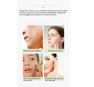 Savon Solide Anti-Acné 2026 OEM Marque Privée, Fait Main, Blanchissant, aux Herbes Naturelles, Équilibrant le pH, pour l'Hygiène Féminine Biologique des Femmes - Product Image 6