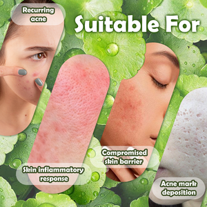 <span class=keywords><strong>ยา</strong></span>แก้สิวอาหารเสริมสมุนไพร Centella Asiatica พร้อมเม็ดทำความสะอาดป้องกั<span class=keywords><strong>น</strong></span>สิว - Product Image 3