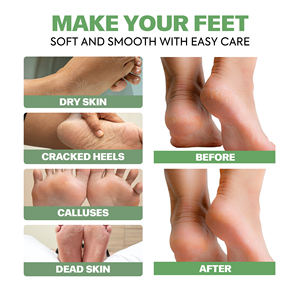 Kit de soins pour les pieds 4 pièces, kit spa pour les pieds, soin des pieds secs et craquelés, crème pour les pieds lissante et nourrissante, cadeau pour Noël, anniversaire, Saint-Valentin - Product Image 6