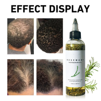 LANYAN Nouveau Produit Huile Capillaire et Corporelle au Romarin et à l'Huile de Batana pour la Croissance des Cheveux, en Flacon