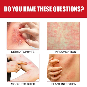 ครีมอัลตร้าสมูทติ้งขายส่ง บรรเทาอาการคันจากยุงกัด ลดรอยแดงและอาการระคายเคือง ครีมบำรุงผิว - Product Image 4