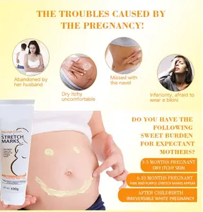 Ama zon Hot Sale Best Natural Anti Vergeture Repair Scar Stretch Mark Removal Cream