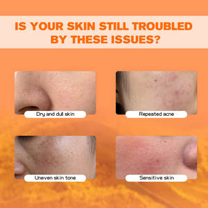 Etiqueta privada Cuidado DE LA PIEL Hidratante Blanqueamiento <span class=keywords><strong>Crema</strong></span> <span class=keywords><strong>facial</strong></span> Eliminación de manchas oscuras Iluminador <span class=keywords><strong>Crema</strong></span> <span class=keywords><strong>facial</strong></span> de cúrcuma - Product Image 3