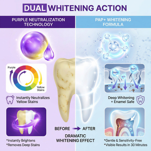 Tiras Blanqueadoras Dentales Púrpuras, Tratamiento para Manchas en los <span class=keywords><strong>Dientes</strong></span>, Tiras Blanqueadoras Púrpuras que Combinan Blanqueamiento y Corrección del Color - Product Image 2