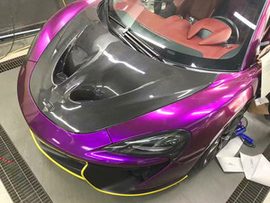 Capó de Fibra de Carbono de Alta Calidad Estilo P1 para McLaren 570s 570GT 540c, Nuevo Capó Mejorado para Motor P1 - Product Image 4
