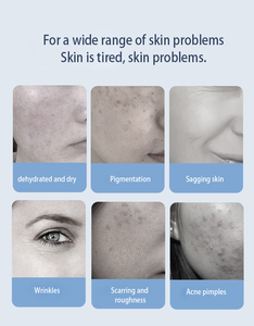 Sistema de Gestión de la Piel 6 en 1, Solución Completa para el Cuidado de la Piel en Salones de Estética, para Eliminar Arrugas - Product Image 4