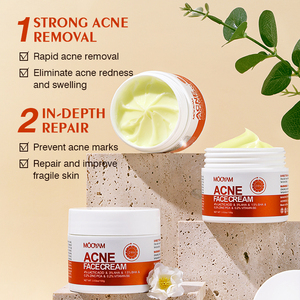 Crema para el Acné <span class=keywords><strong>de</strong></span> Marca Privada del Fabricante, Eficaz y <span class=keywords><strong>de</strong></span> Acción Rápida, con Propiedades Blanqueadoras, Ácido Hialurónico y <span class=keywords><strong>Aloe</strong></span> <span class=keywords><strong>Vera</strong></span> - Product Image 2