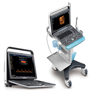 Équipement médical à ultrasons Sonoscape S9, appareil à ultrasons portable, échographe Doppler - Product Image 6