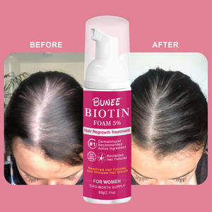 Nouvelle mousse de croissance des cheveux d'usine Calvicie Nutrition renforce empêche la perte et irrite les follicules pileux - Product Image 3