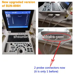 Medische Echografie Ecografia Portatil SUN-806H Echografie Draagbare Instrumenten Ultrasone Machine