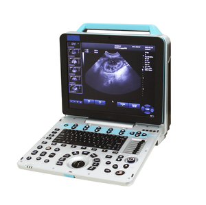 Sistema Diagnostico Veterinario a Ultrasuoni Doppler da 15 Pollici per <span class=keywords><strong>Esame</strong></span> Ostetrico di Bovini, Cavalli, Suini, Ovini, Cani e Gatti - Product Image 6