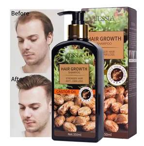 Castor Oil Shampoo Hair Loss Treatment For Men